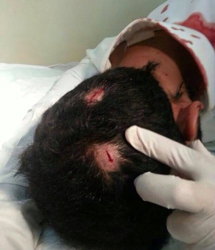 مخالفة طالب طعن معلم: السماح بالاختبار