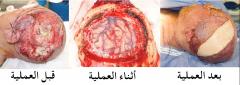 تنزيل (18)