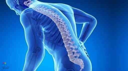 6 عادات تسبب هشاشة العظام
