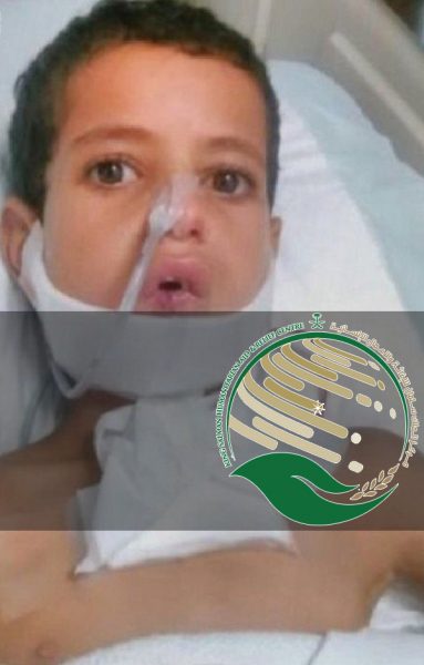 مركز الملك سلمان للإغاثة يبادر بعلاج طفل يمني أصيب بقذيفة حوثية