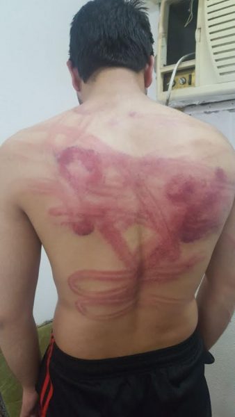 الرياض.. ضبط عصابة تسلب العمالة وتعذبهم بالسياط