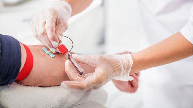 التبرع بالدم: أفضل الأوقات؟ - استشاري يجيب