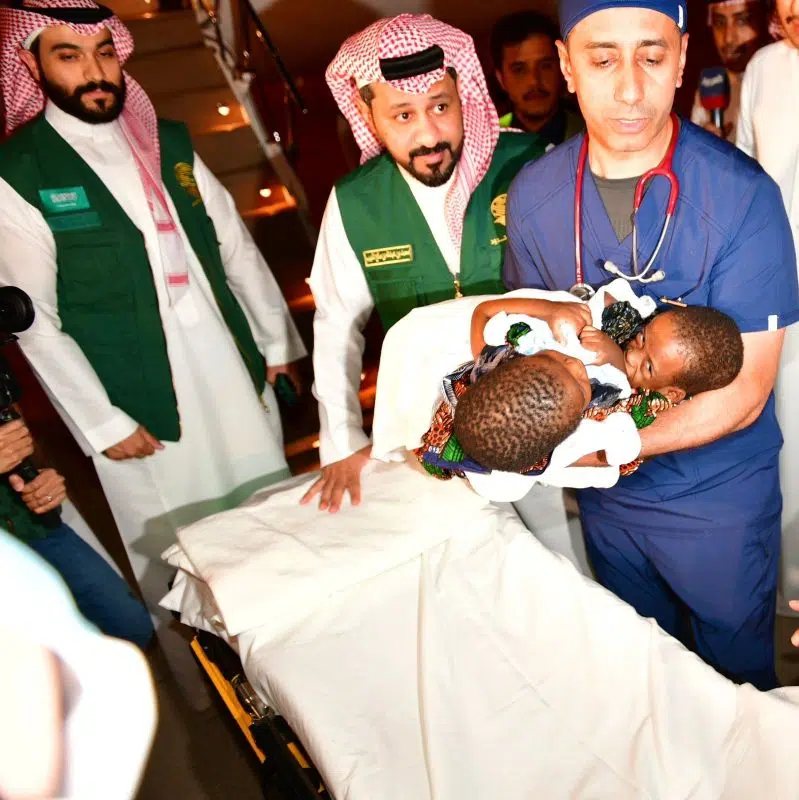 وصول التوأم السيامي التنزاني حسن وحسين إلى الرياض