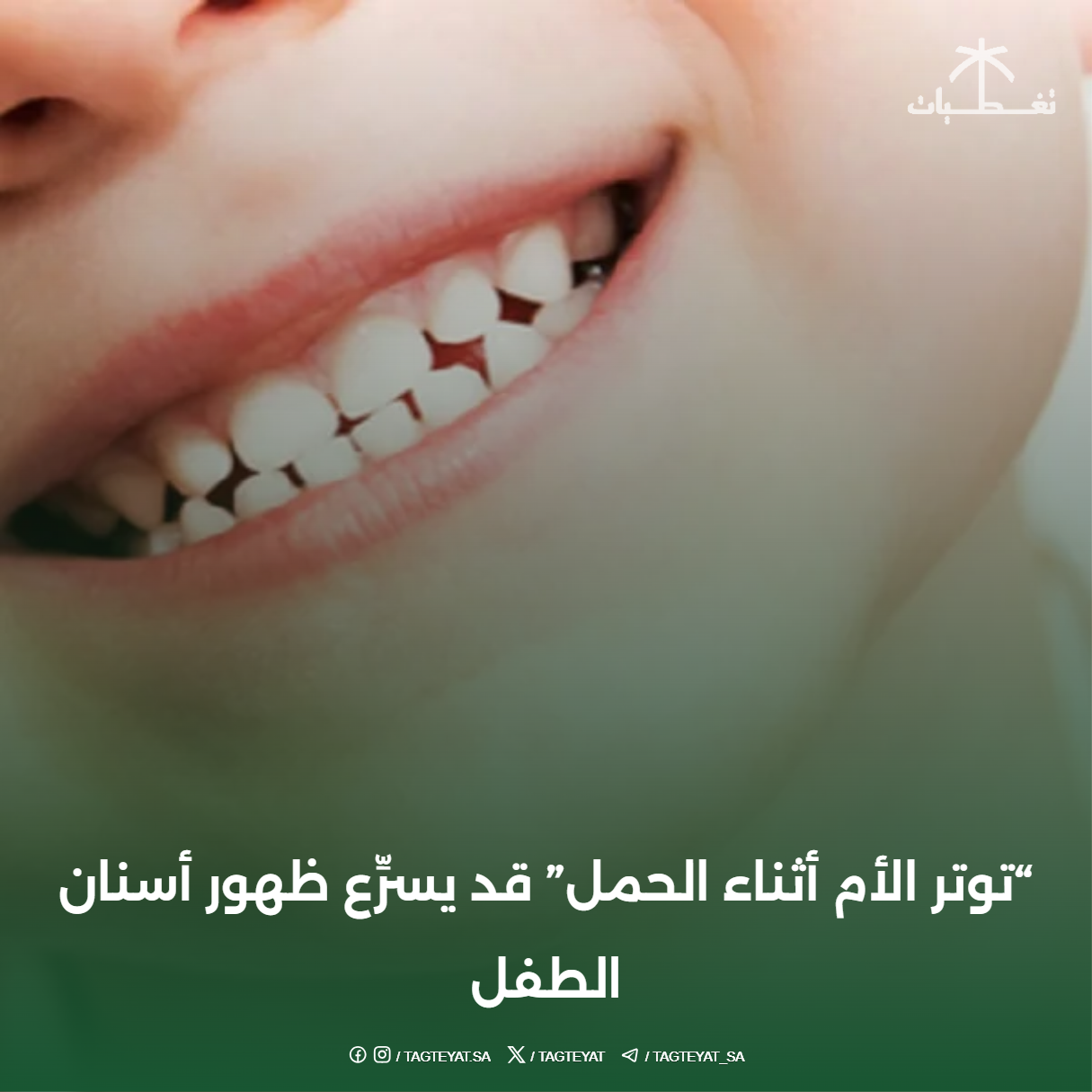 "توتر الأم أثناء الحمل" قد يسرِّع ظهور أسنان الطفل