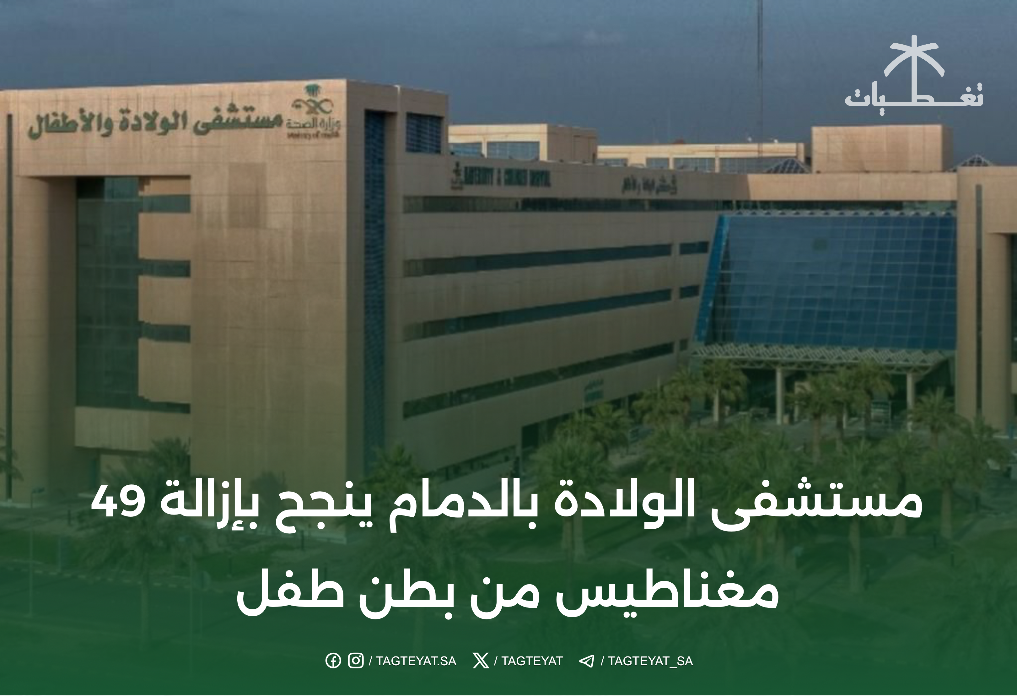 مستشفى الولادة بالدمام ينجح بإزالة 49 مغناطيس من بطن طفل