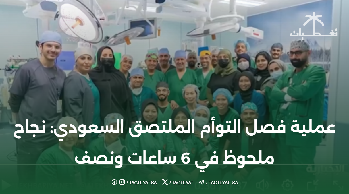 عملية فصل التوأم الملتصق السعودي: نجاح ملحوظ في 6 ساعات ونصف