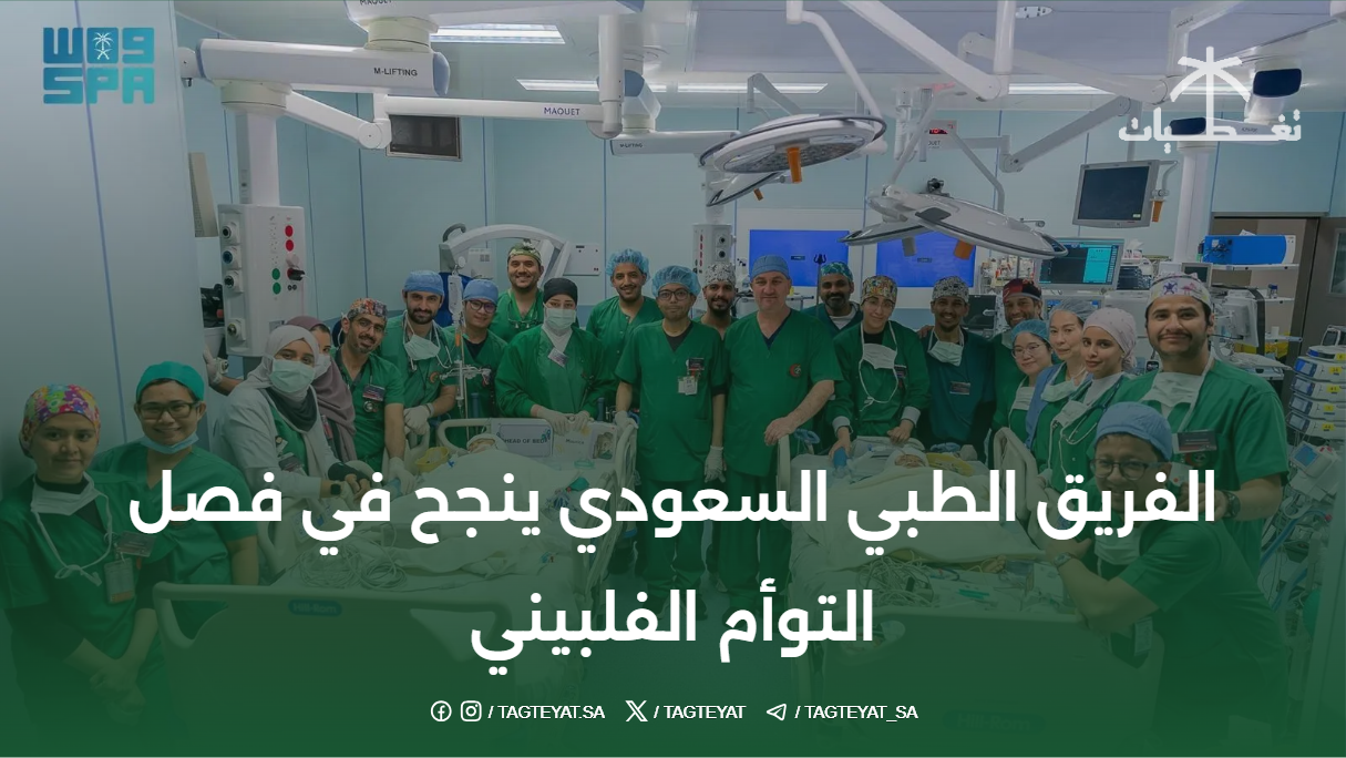 الفريق الطبي السعودي ينجح في فصل التوأم الفلبيني بعد عملية استغرقت 18 ساعة